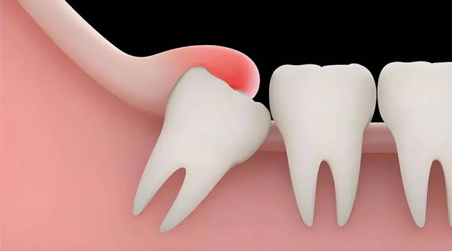 九游娱乐:口腔健康从细节做起(图2)