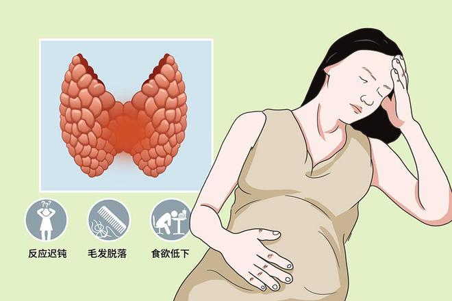 孕妇注意！甲状腺功能减退可能影响胎儿健康！(图3)