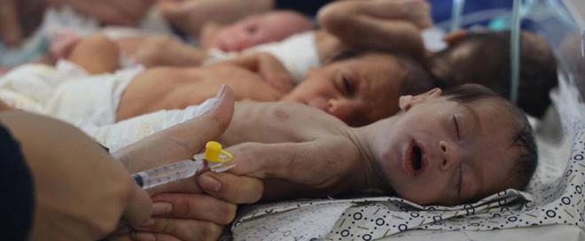 全球震惊：加沙饥饿婴儿照片曝光营养不良、面部紧缩犹如外星人(图7)