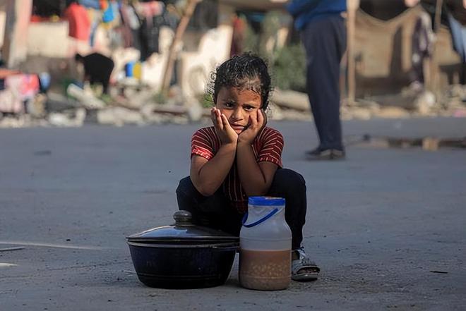 全球震惊：加沙饥饿婴儿照片曝光营养不良、面部紧缩犹如外星人(图12)