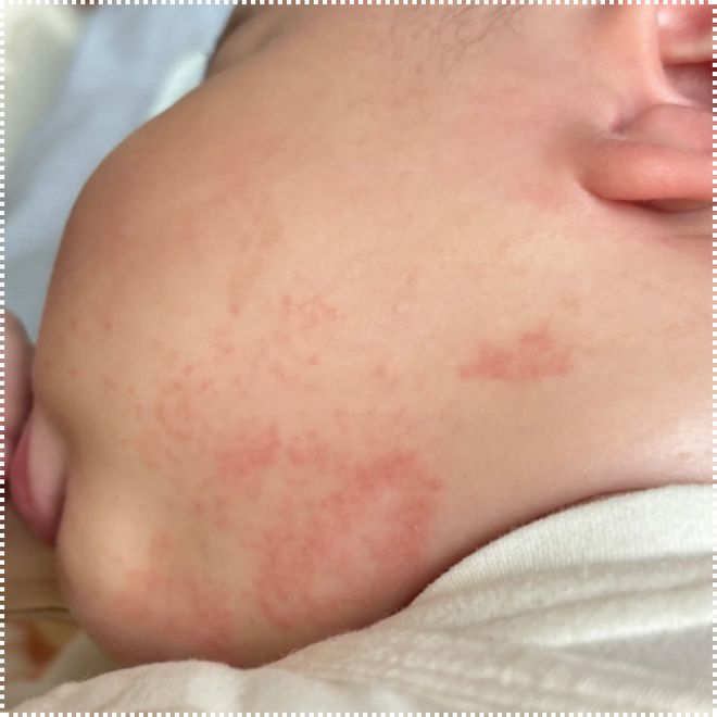 九游娱乐:儿科医生认可品牌:2025新生儿脸上长红色小疹子擦什么面霜排行榜(图3)