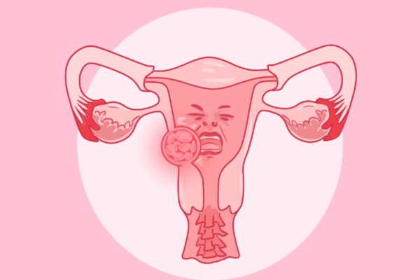 女性生殖保健的重要性(图1)